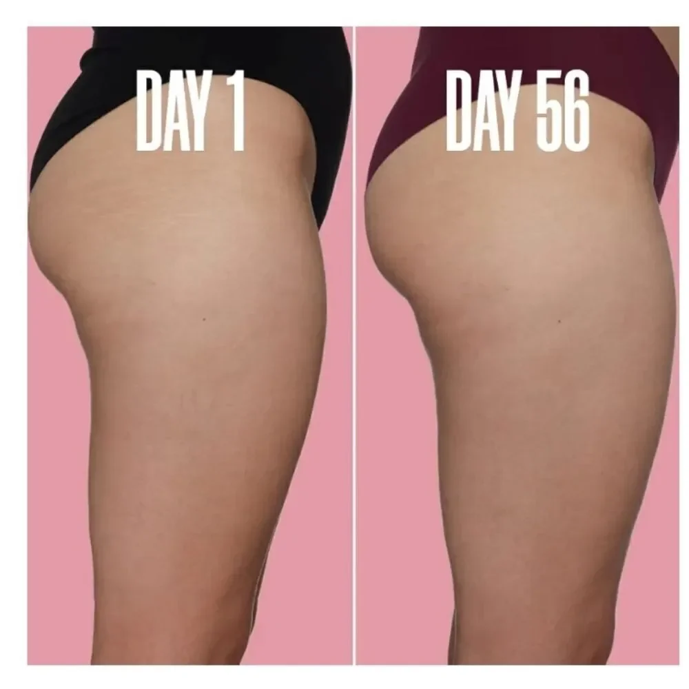 Maelys B-SLEEK Outer Thigh Stretch Mark Cream